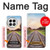 S3866 Railway Straight Train Track Case For OnePlus 13