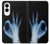 S3239 X-Ray Hand Sign OK Case For Samsung Galaxy S25 Edge