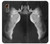 S1593 Ballet Pointe Shoe Case For Samsung Galaxy XCover7