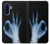 S3239 X-Ray Hand Sign OK Case For Samsung Galaxy A17