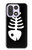 S2509 Fishbone Case For OnePlus 15