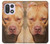 S2903 American Pitbull Dog Case For OnePlus 15