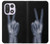 S3101 X-ray Peace Sign Fingers Case For OnePlus 15