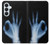 S3239 X-Ray Hand Sign OK Case For Samsung Galaxy S26 Plus