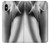 S1023 Gorgeus Sexy Girl Case For iPhone X, iPhone XS