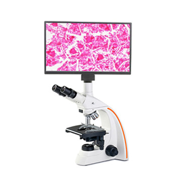 Steindorff S-B-2800 Trinocular Biological Microscope with 13.3" LCD Display 4K Camera Steindorff S-B-2800 Trinocular Biological Microscope with 13.3" LCD Display 4K Camera
