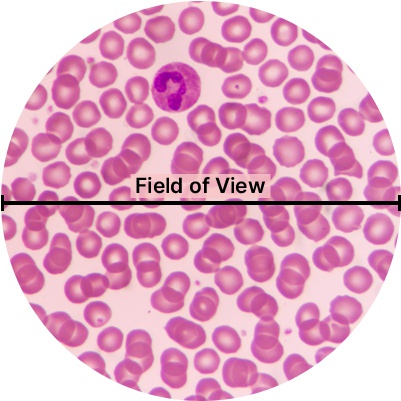 Blood cells under the microscope