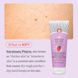 KP Bump Eraser Body Scrub 10% AHA – Fresh Strawberry