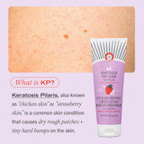 KP Bump Eraser Body Scrub 10% AHA – Fresh Strawberry Travel Size