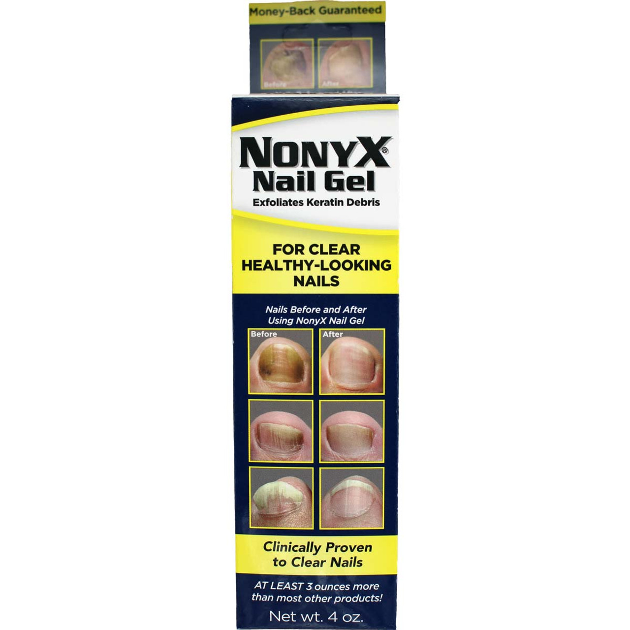 Nonyx Nail Gel Stores