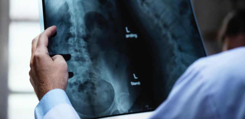 5 Things To Do for Better Bone Health (Osteoporosis Awareness Month)