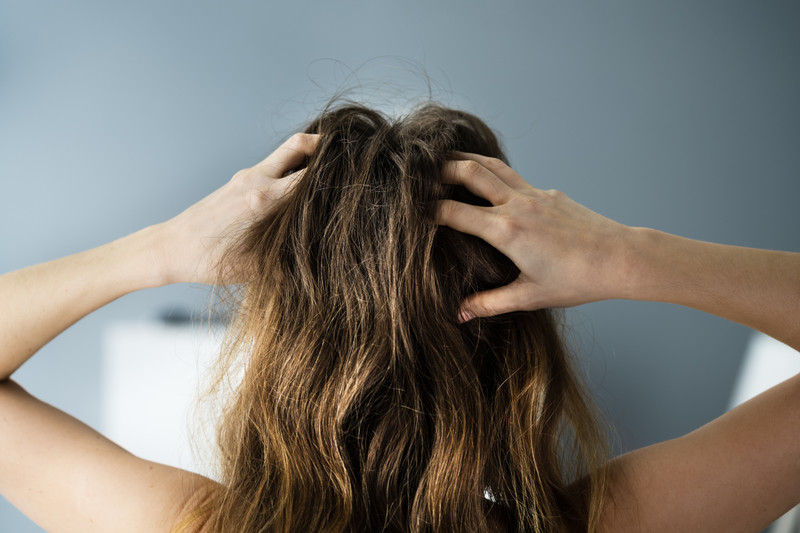 4 Natural Supplements to Treat Winter’s Dry Scalp Wonder Laboratories