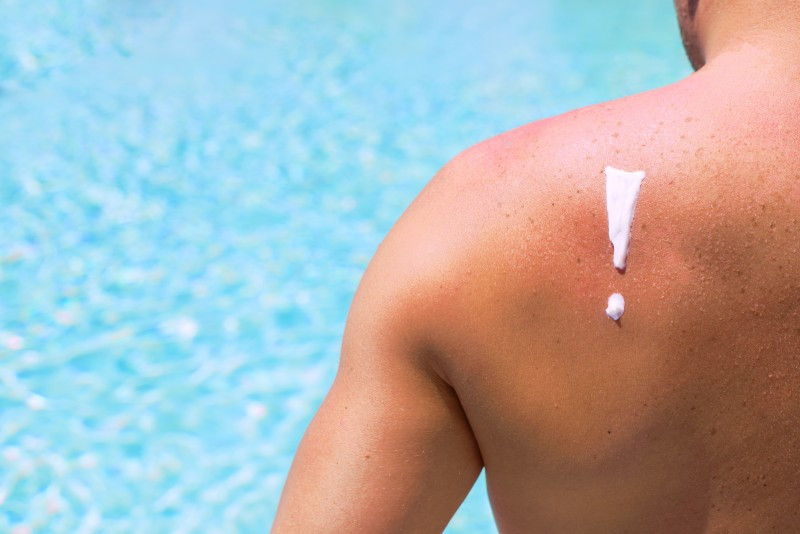 Can Certain Supplements Help Prevent Sunburn in Summer?