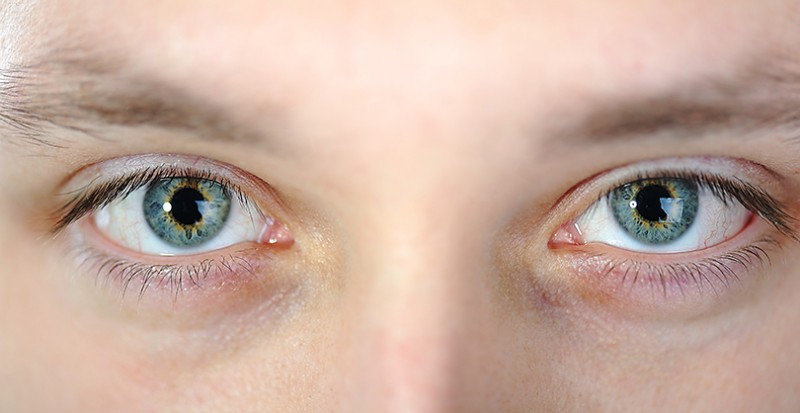 Eyebright: What Is It and What Does It Do?