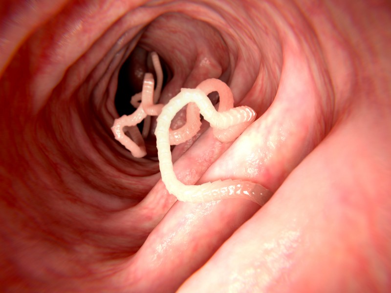 4 Natural Remedies for Parasites/Tapeworms