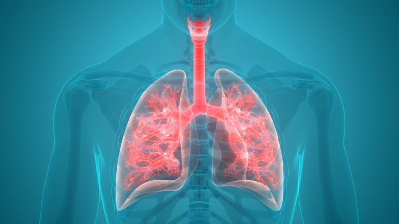 5 Supplements to Bolster Your Protection Against Pneumonia