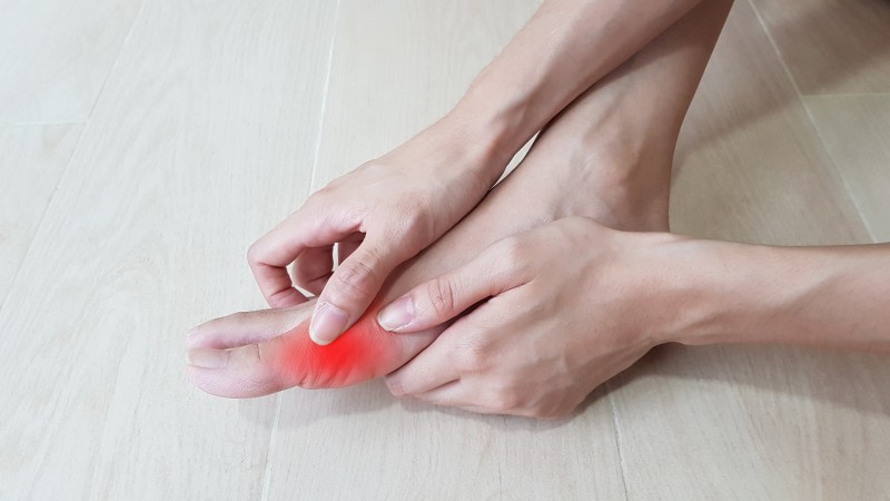 6 Natural Remedies to Help Relieve Gout