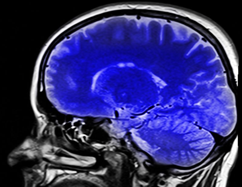 A Discussion on Concussions