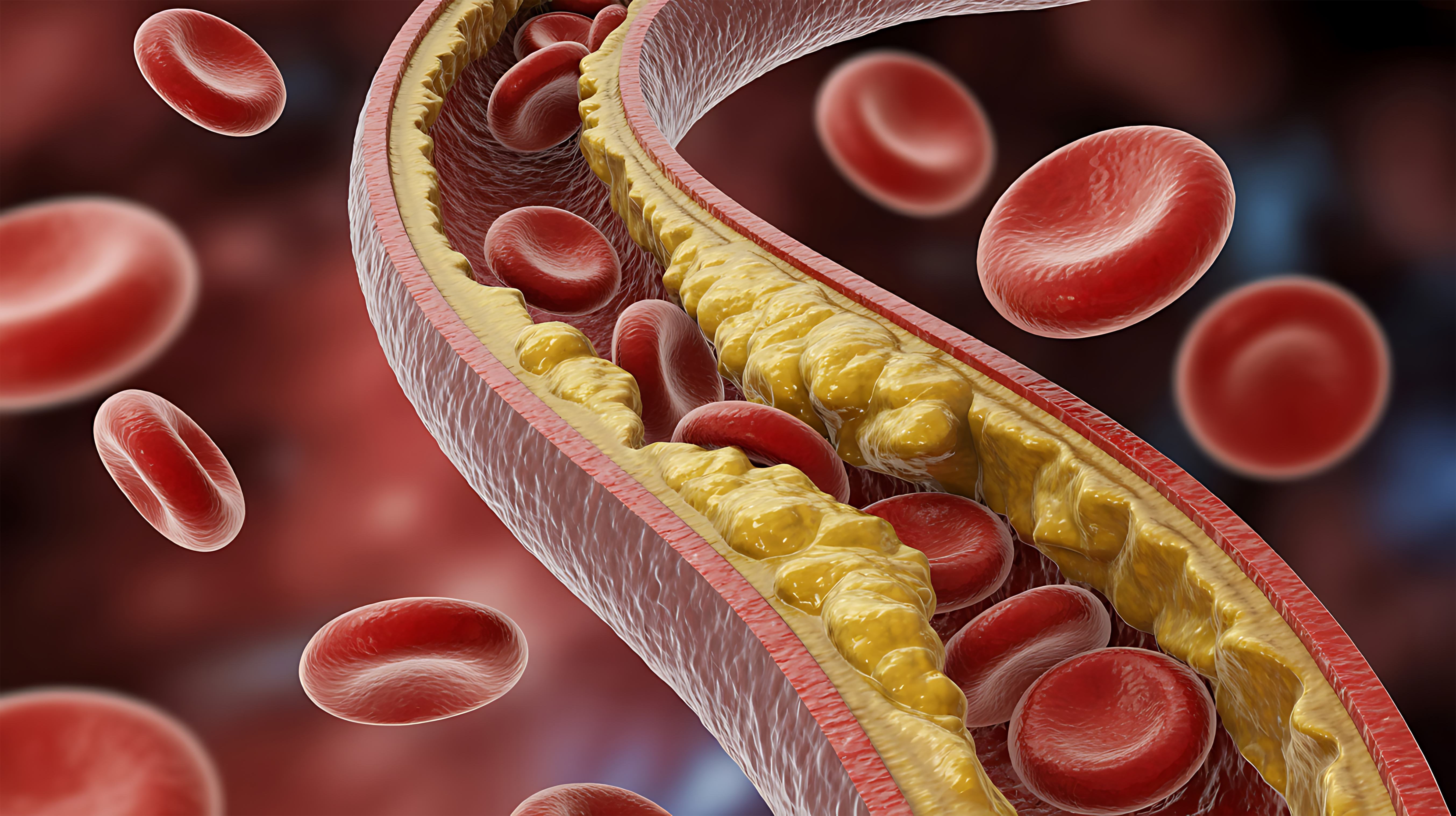4 Choice Supplements for Regulating Cholesterol Levels