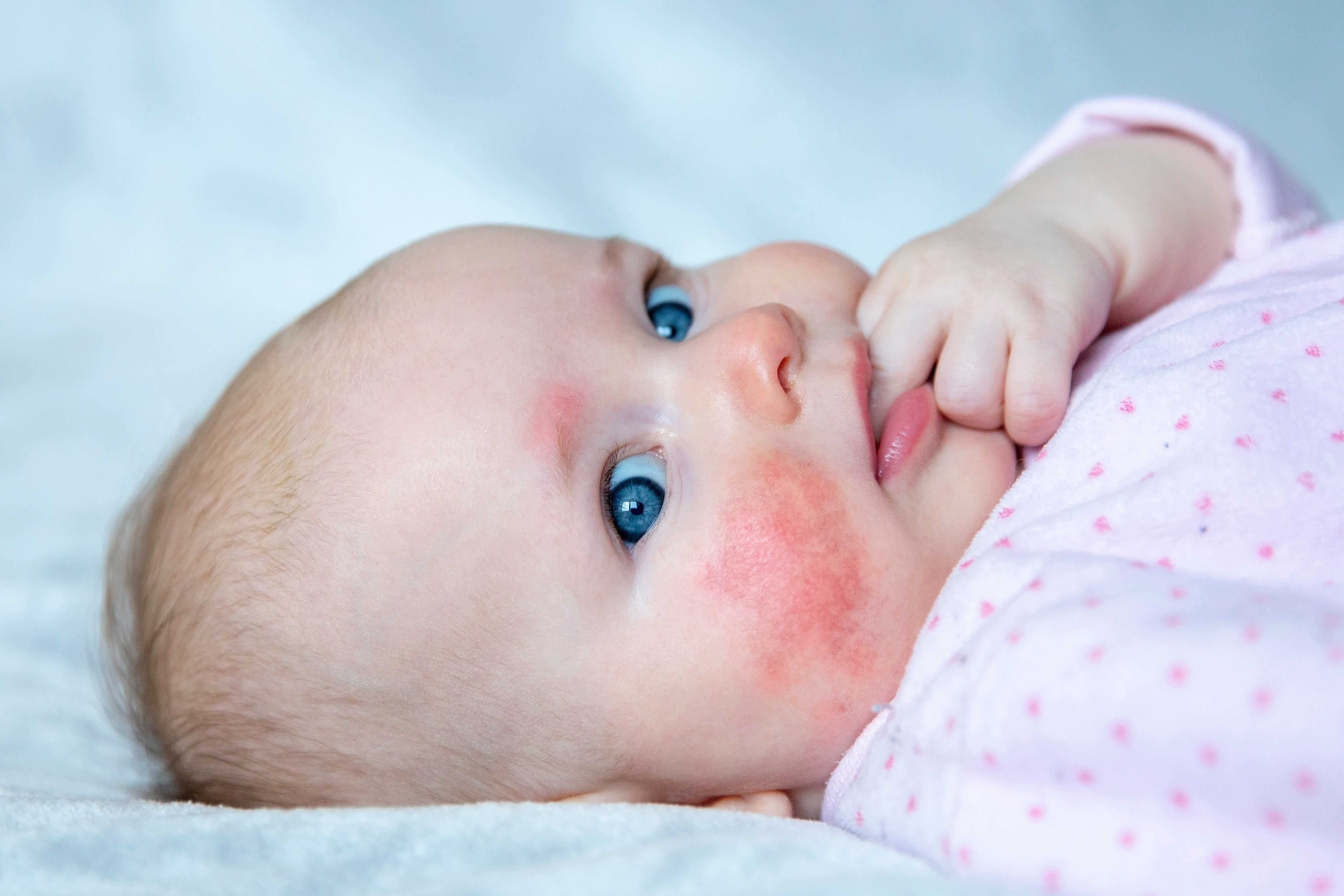4 Natural Remedies to Address Baby Rash