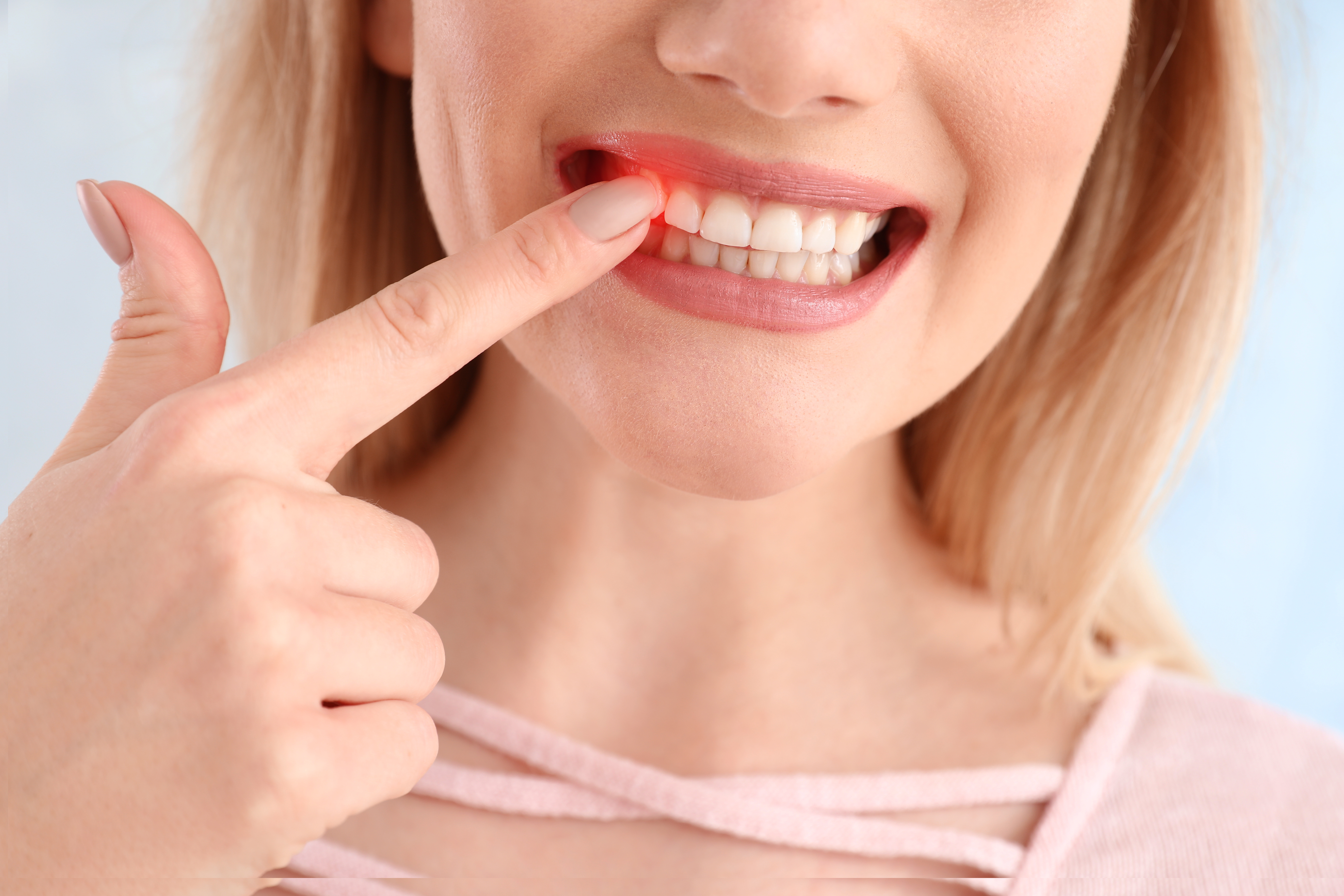Vitamins for Healthy Gums (Stop Bleeding Gums!)