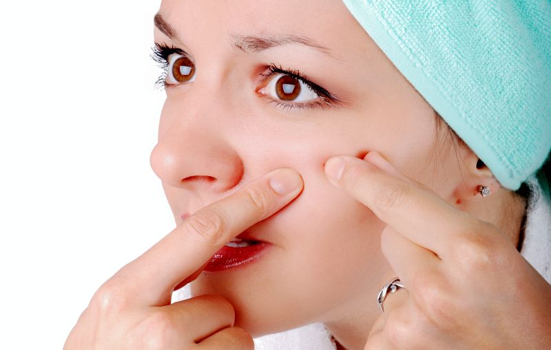 Adult Acne Can Spoil the Nostalgia Craze