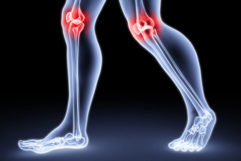 Simple Steps to Help Relieve Arthritis-Related Joint Pain