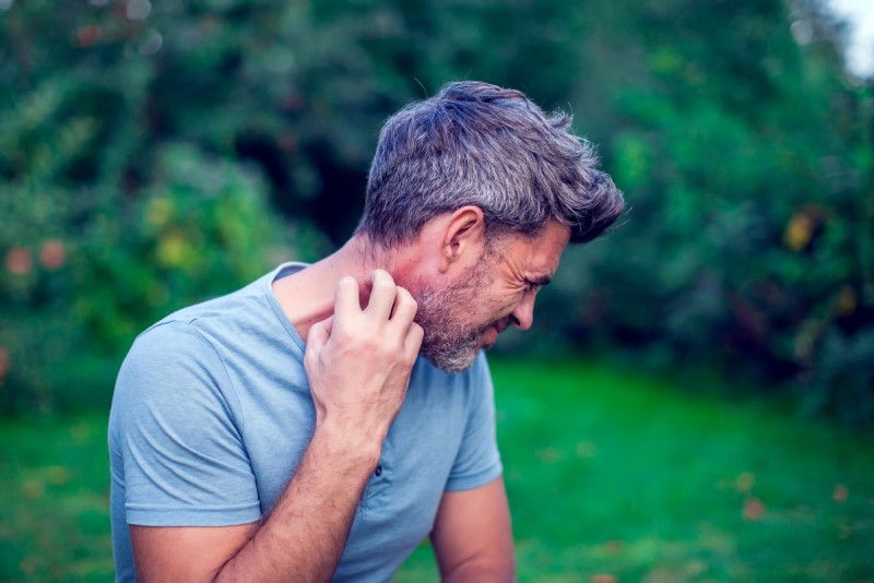 What Exactly Is Ringworm? How Can It Be Treated?