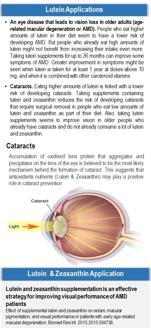 AMD and Cataracts