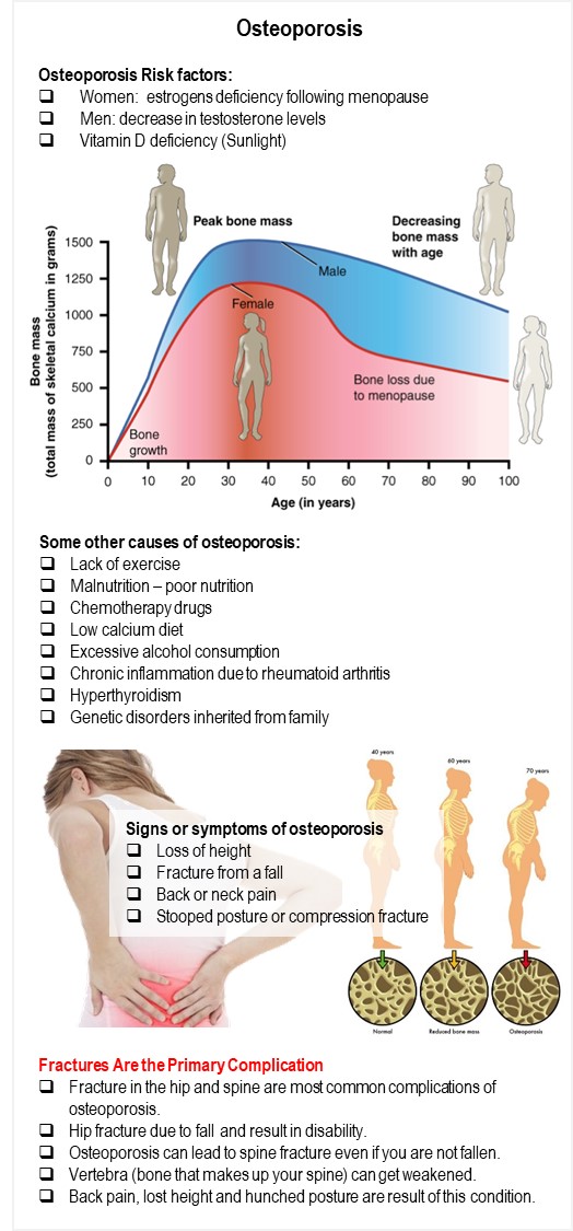 Signs and Symptoms of Osteoporosis