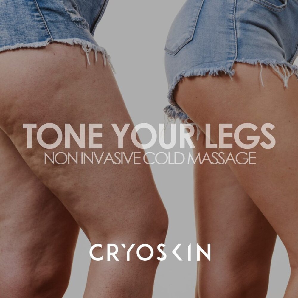 Elk Grove Laguna News, @total.sculpting Check this CRYOSKIN TONING  transformation and these legs!🔥😮 This is Cryoskin's power: diminish  cellulite, tighte