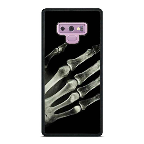 X Ray Hand Holding Samsung Galaxy Note 9 Case Cover
