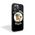 Im So Smart, It Hurts iPhone 15 Case Cover