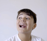 Unlocking the Benefits of Orofacial Myofunctional Therapy for Optimal Oral Health