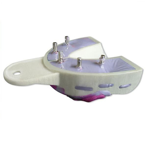 Hager & Werken Miratray Implant Tray - Large Lower