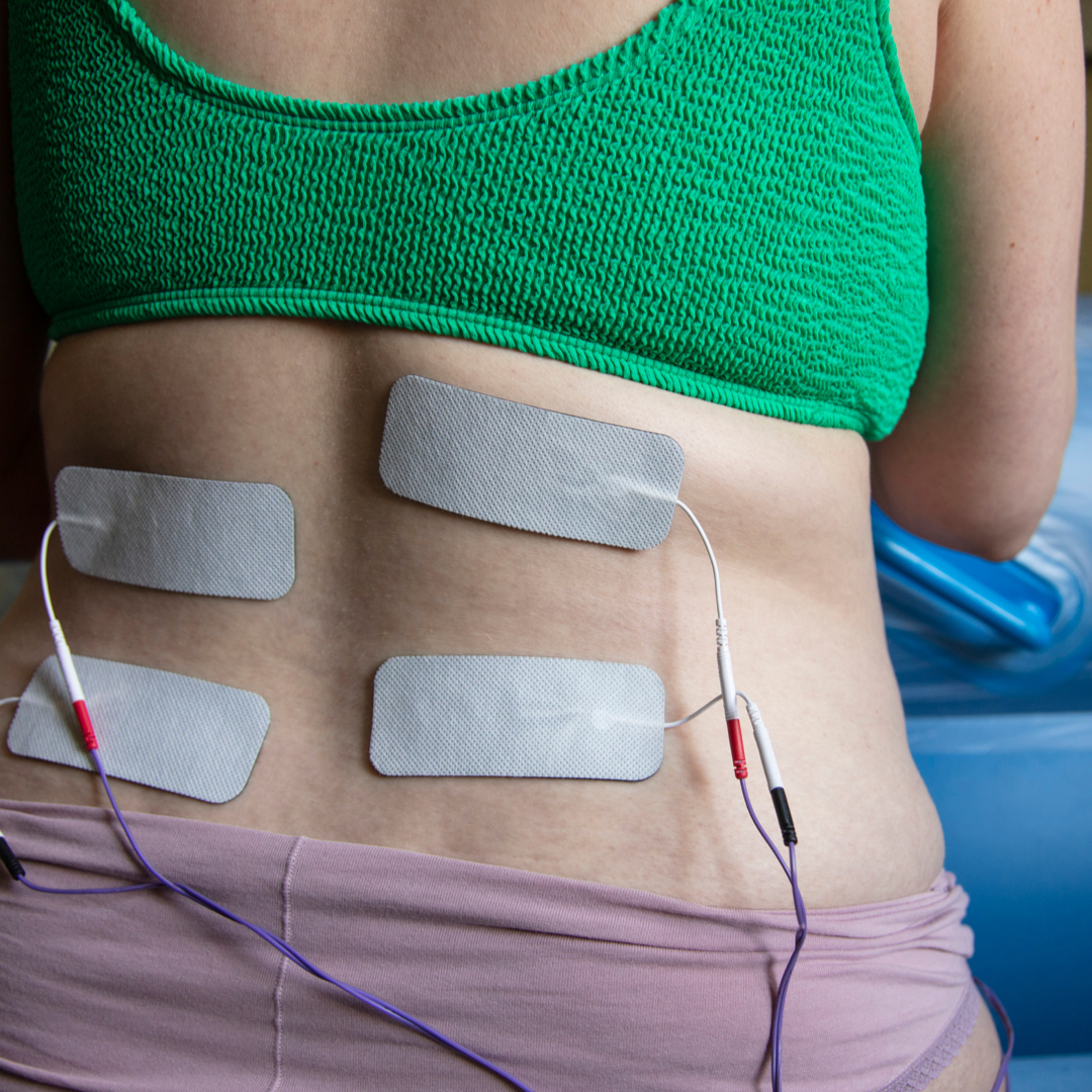 Natural Pain Relief Options in Labour Birthmother