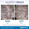 Douglas Labs Hair Growth+ - 60 Capsules