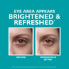 Before and after photos of an under-eye area, brightened and refreshed
