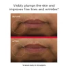 Before and after lip area photos from a 12-week study