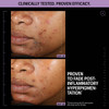 Day 1 and day 14 skin tone comparison, Allies of Skin clinical results