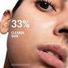 Close-up of a woman's face with clearer skin results graphic