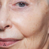 Close-up of mature skin with fine lines and age spots around the eye