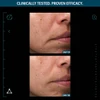 Day 01 and Day 56 fine lines comparison, clinically tested graphic