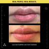 Lips before and after on day 1 and day 5, real people real results