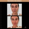 Before and after 8 hours on a second model, real people real results