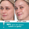 Before and after 1 week Collagen Skinjection radiant glowy skin graphic