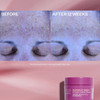 Super-C Night cream before and after 12 weeks UV pigment graphic