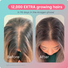 Advanced Hair Growth before and after scalp density 90 days graphic