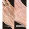 Hand before and after 12 weeks comparison