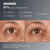 Before and after 4 weeks undereye photos with consumer survey results